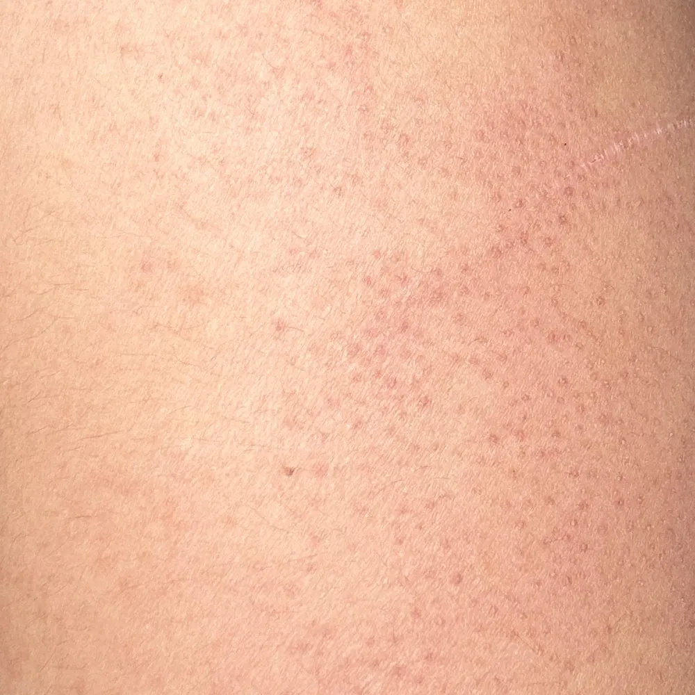 After-Shower Nourishing Body Oil