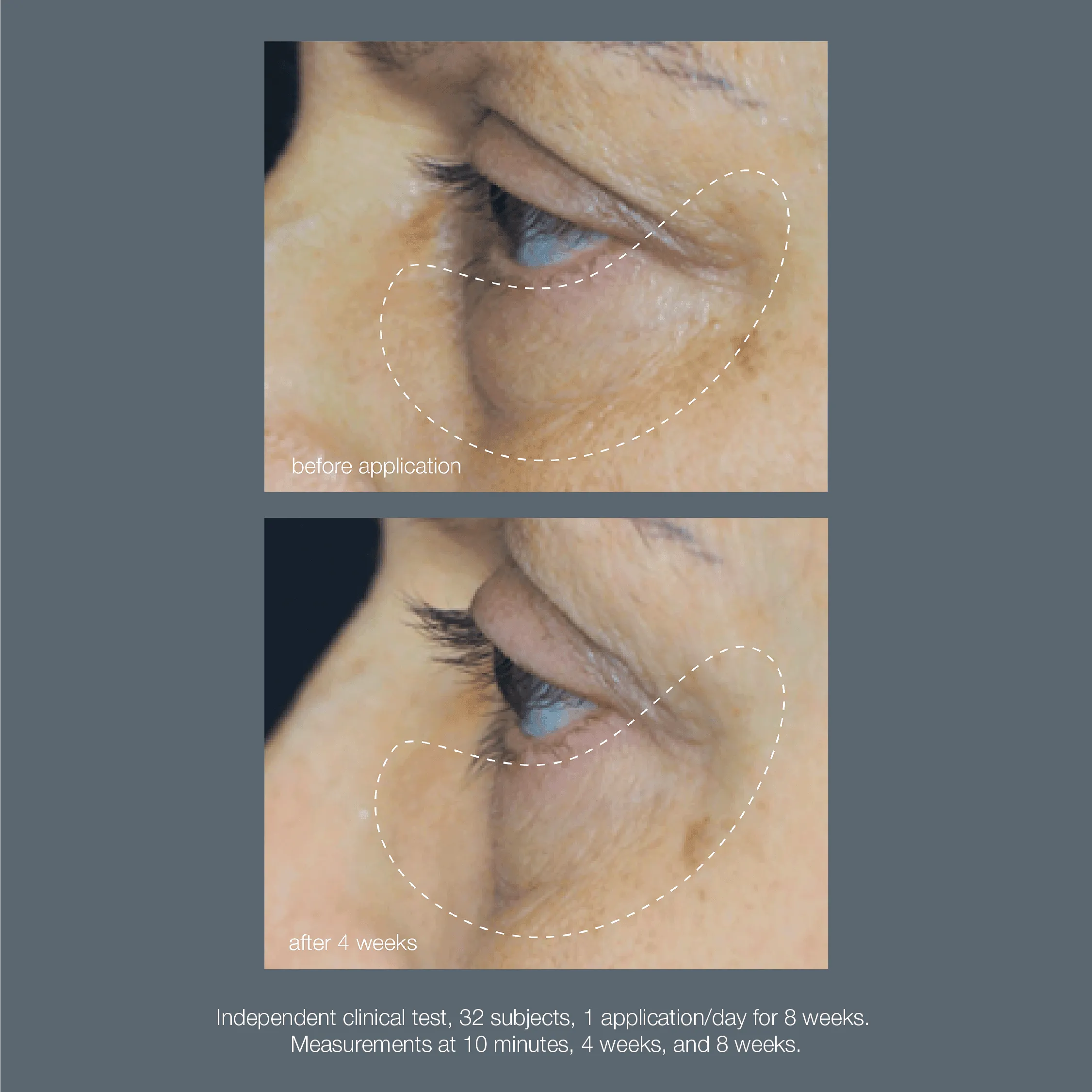 awaken peptide depuffing eye gel