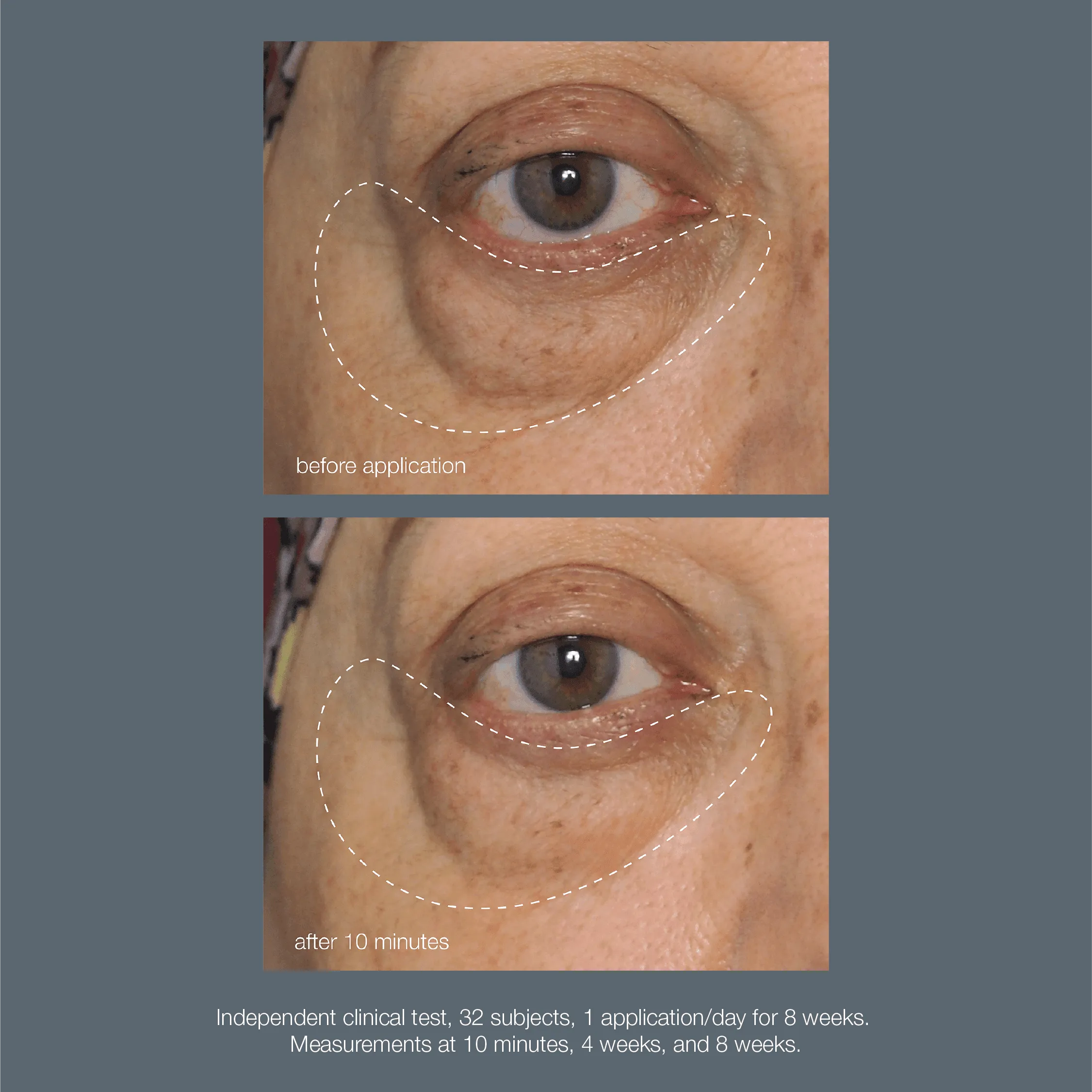 awaken peptide depuffing eye gel