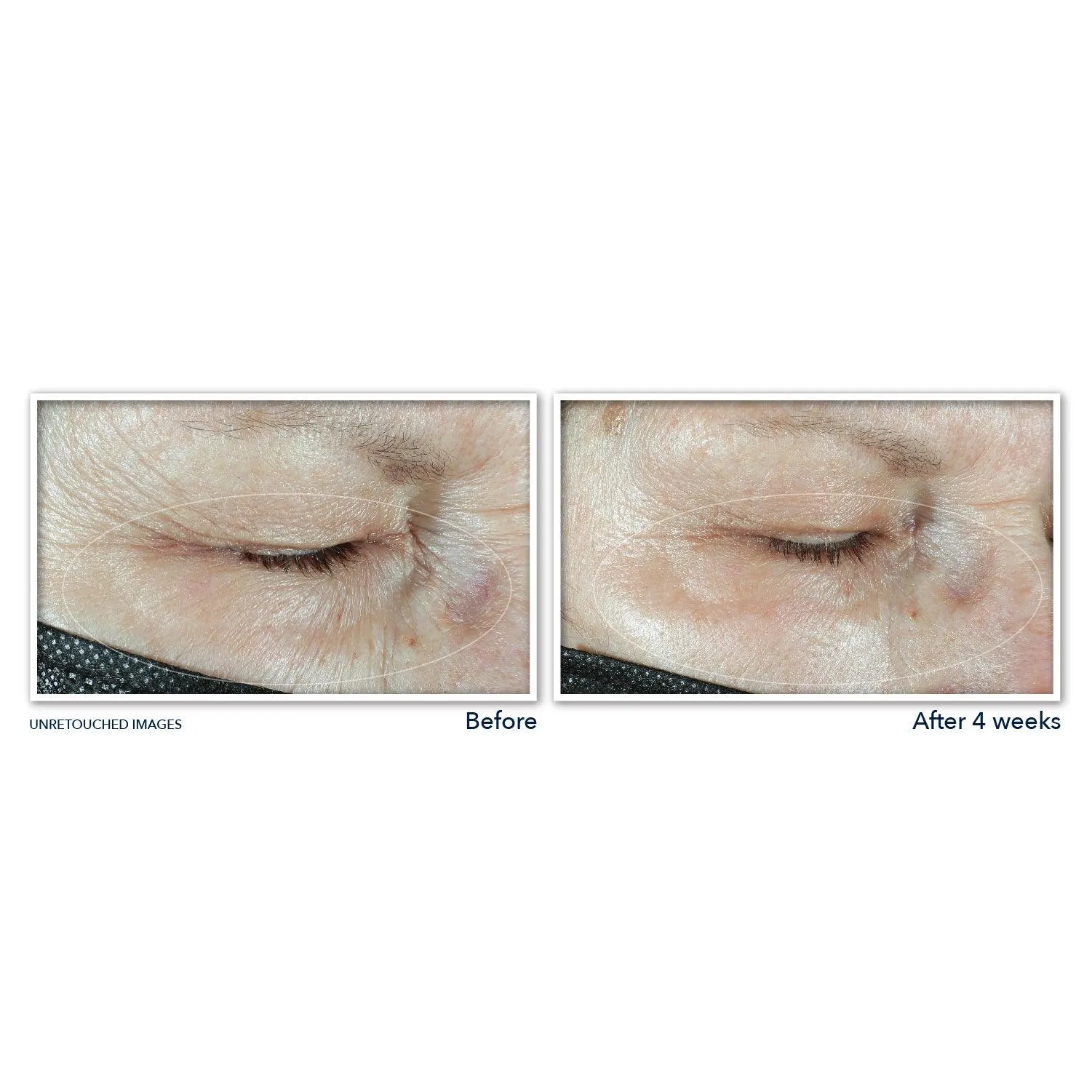 MULTI CORREXION® Hydrate   Plump Eye Cream