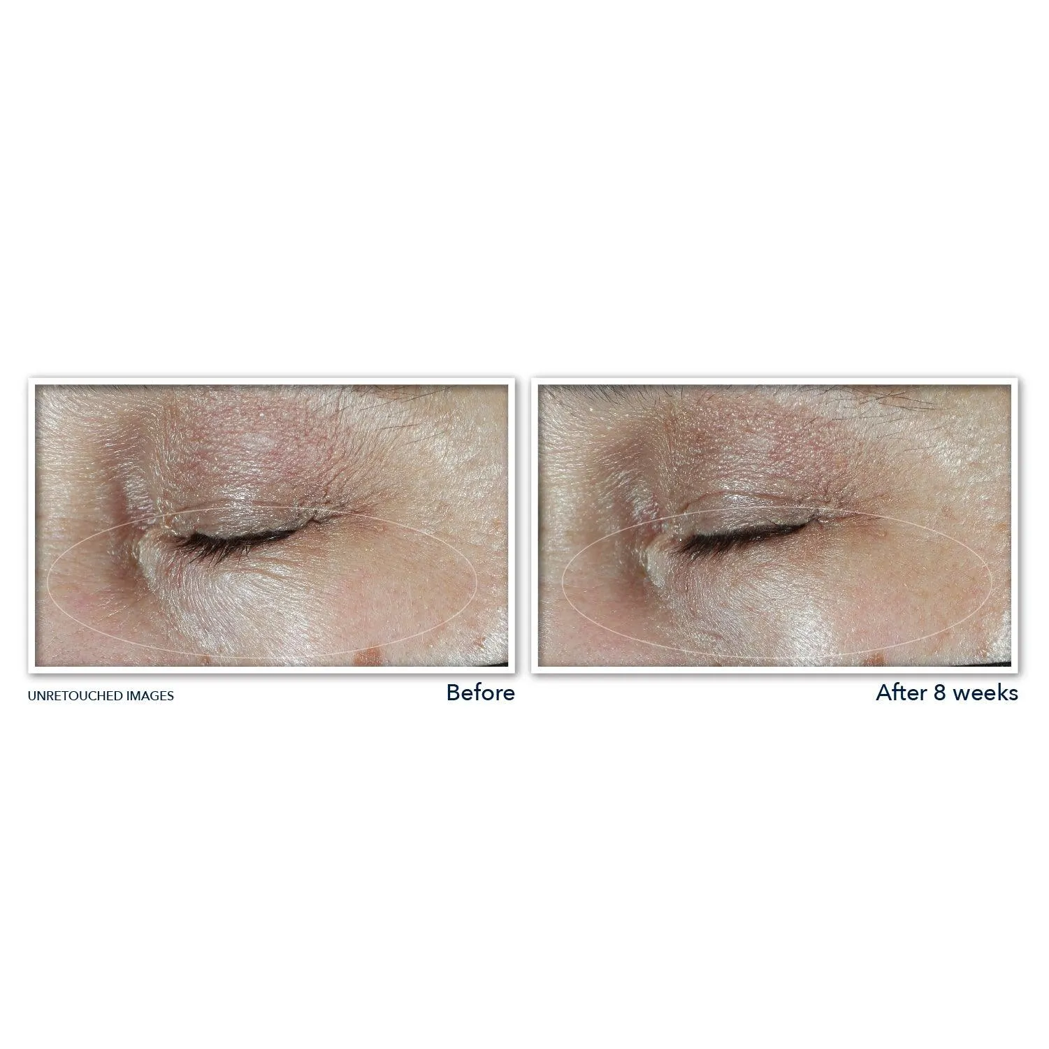 MULTI CORREXION® Hydrate   Plump Eye Cream