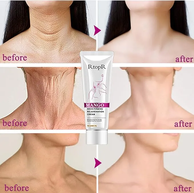 Neck Firming Cream, Neck Cream, Anti Wrinkle Cream, Skin Tightening Cream, Double Chin Reducer Cream, Neck and Chest Tightening Cream, Tightening Sagging Skin, For a Wrinkle-Free