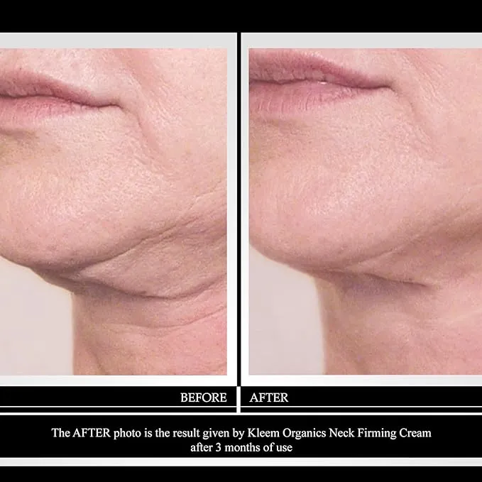 Neck Firming Cream with Peptides, Neck Cream, Anti Wrinkle Cream, Double Chin Reducer Cream, Skin Tightening and Crepe Skin Repair Cream - 1.7 Oz